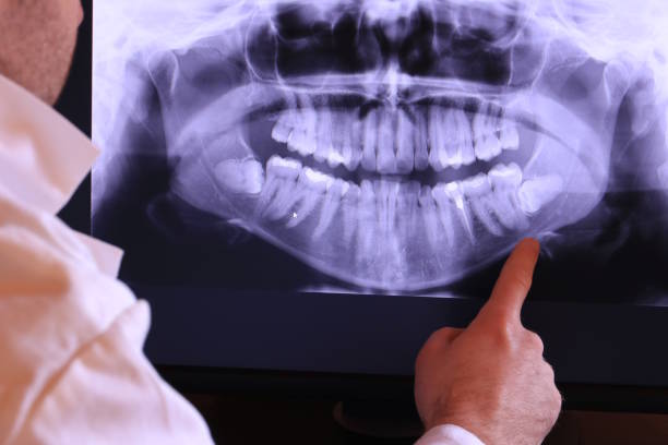Best Emergency Care for Gum Disease in Colfax, IL